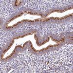 BET1L Antibody in Immunohistochemistry (Paraffin) (IHC (P))