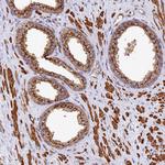 BET1L Antibody in Immunohistochemistry (Paraffin) (IHC (P))