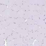 BET1L Antibody in Immunohistochemistry (Paraffin) (IHC (P))