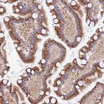 BET1L Antibody in Immunohistochemistry (Paraffin) (IHC (P))