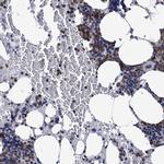 RhoG Antibody in Immunohistochemistry (IHC)