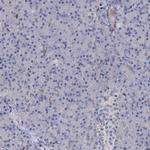 RhoG Antibody in Immunohistochemistry (IHC)