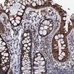 NDUFA12 Antibody in Immunohistochemistry (Paraffin) (IHC (P))