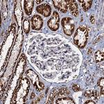 NDUFA12 Antibody in Immunohistochemistry (Paraffin) (IHC (P))