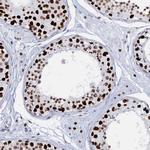 CMAS Antibody in Immunohistochemistry (Paraffin) (IHC (P))