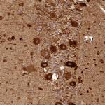 BCDIN3D Antibody in Immunohistochemistry (Paraffin) (IHC (P))