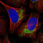 UBE3C Antibody in Immunocytochemistry (ICC/IF)