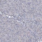 UBE3C Antibody in Immunohistochemistry (Paraffin) (IHC (P))