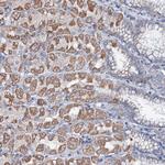 UBE3C Antibody in Immunohistochemistry (Paraffin) (IHC (P))