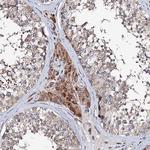 UBE3C Antibody in Immunohistochemistry (Paraffin) (IHC (P))