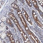 MRPL51 Antibody in Immunohistochemistry (Paraffin) (IHC (P))