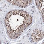 ATP8A2 Antibody in Immunohistochemistry (Paraffin) (IHC (P))