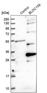 Pallidin Antibody in Western Blot (WB)