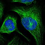 LRTOMT Antibody in Immunocytochemistry (ICC/IF)