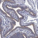 LRTOMT Antibody in Immunohistochemistry (IHC)