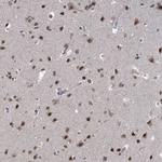 FANCI Antibody in Immunohistochemistry (Paraffin) (IHC (P))