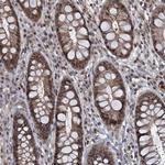 FANCI Antibody in Immunohistochemistry (Paraffin) (IHC (P))