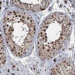 FANCI Antibody in Immunohistochemistry (Paraffin) (IHC (P))