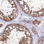 MNS1 Antibody in Immunohistochemistry (IHC)