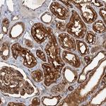 NPAL3 Antibody in Immunohistochemistry (Paraffin) (IHC (P))