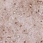 RARS2 Antibody in Immunohistochemistry (Paraffin) (IHC (P))