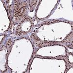 MPP8 Antibody in Immunohistochemistry (IHC)