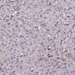 MPP8 Antibody in Immunohistochemistry (IHC)