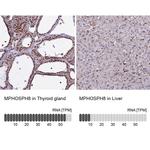 MPP8 Antibody