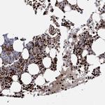 RNF6 Antibody in Immunohistochemistry (Paraffin) (IHC (P))