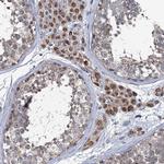 METTL4 Antibody in Immunohistochemistry (Paraffin) (IHC (P))