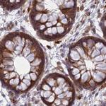 WDR61 Antibody in Immunohistochemistry (IHC)