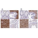 SYNM Antibody in Immunohistochemistry (IHC)