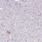 SYNM Antibody in Immunohistochemistry (IHC)