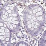 SYNM Antibody in Immunohistochemistry (IHC)