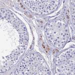 OAT Antibody in Immunohistochemistry (IHC)