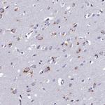 OAT Antibody in Immunohistochemistry (IHC)