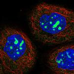 NOP2 Antibody in Immunocytochemistry (ICC/IF)