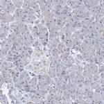 NOP2 Antibody in Immunohistochemistry (Paraffin) (IHC (P))