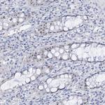 NOP2 Antibody in Immunohistochemistry (Paraffin) (IHC (P))