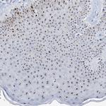 NOP2 Antibody in Immunohistochemistry (Paraffin) (IHC (P))