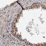 ZC3H13 Antibody in Immunohistochemistry (Paraffin) (IHC (P))