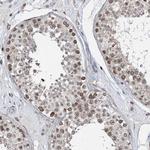 ZC3H13 Antibody in Immunohistochemistry (Paraffin) (IHC (P))