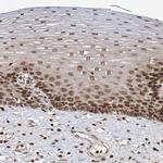 ZC3H13 Antibody in Immunohistochemistry (IHC)