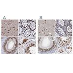 CSTF3 Antibody in Immunohistochemistry (IHC)