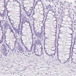 TGM1 Antibody in Immunohistochemistry (Paraffin) (IHC (P))