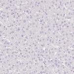 TGM1 Antibody in Immunohistochemistry (Paraffin) (IHC (P))