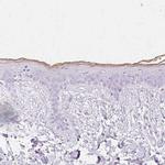 TGM1 Antibody in Immunohistochemistry (Paraffin) (IHC (P))