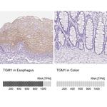 TGM1 Antibody in Immunohistochemistry (IHC)