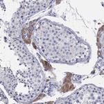 AOX1 Antibody in Immunohistochemistry (Paraffin) (IHC (P))