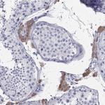 AOX1 Antibody in Immunohistochemistry (Paraffin) (IHC (P))